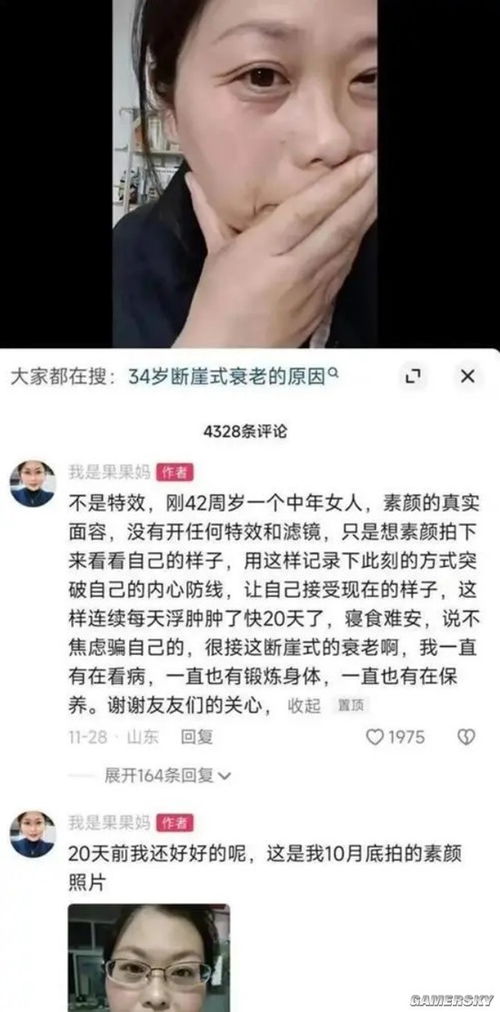 渐冻症女生面对年龄与入组条件的挑战